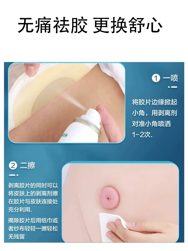 造口黏胶祛除喷剂剥离剂60ml喷剂造口护理造口底盘除胶剂